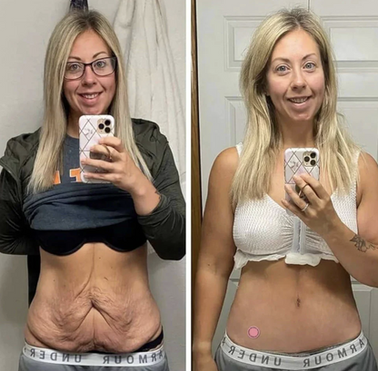 PROGRAMA 8 SEMANAS | 60 Parches VITA GLP-1 · El nuevo aliado discreto y natural para controlar tu cintura y piernas sin pasar hambre. Cambios desde los 7 primeros dias. (*Desarrollado por la nutricionista Elena Mirtires).
