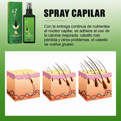 Spray Raíz Viva™· El primer spray natural que recupera tu melena sin injertos costosos. Resultados visibles desde los 9 primeros días (HOY REGALO ducha con filtro que evita el daño capilar GRATIS).