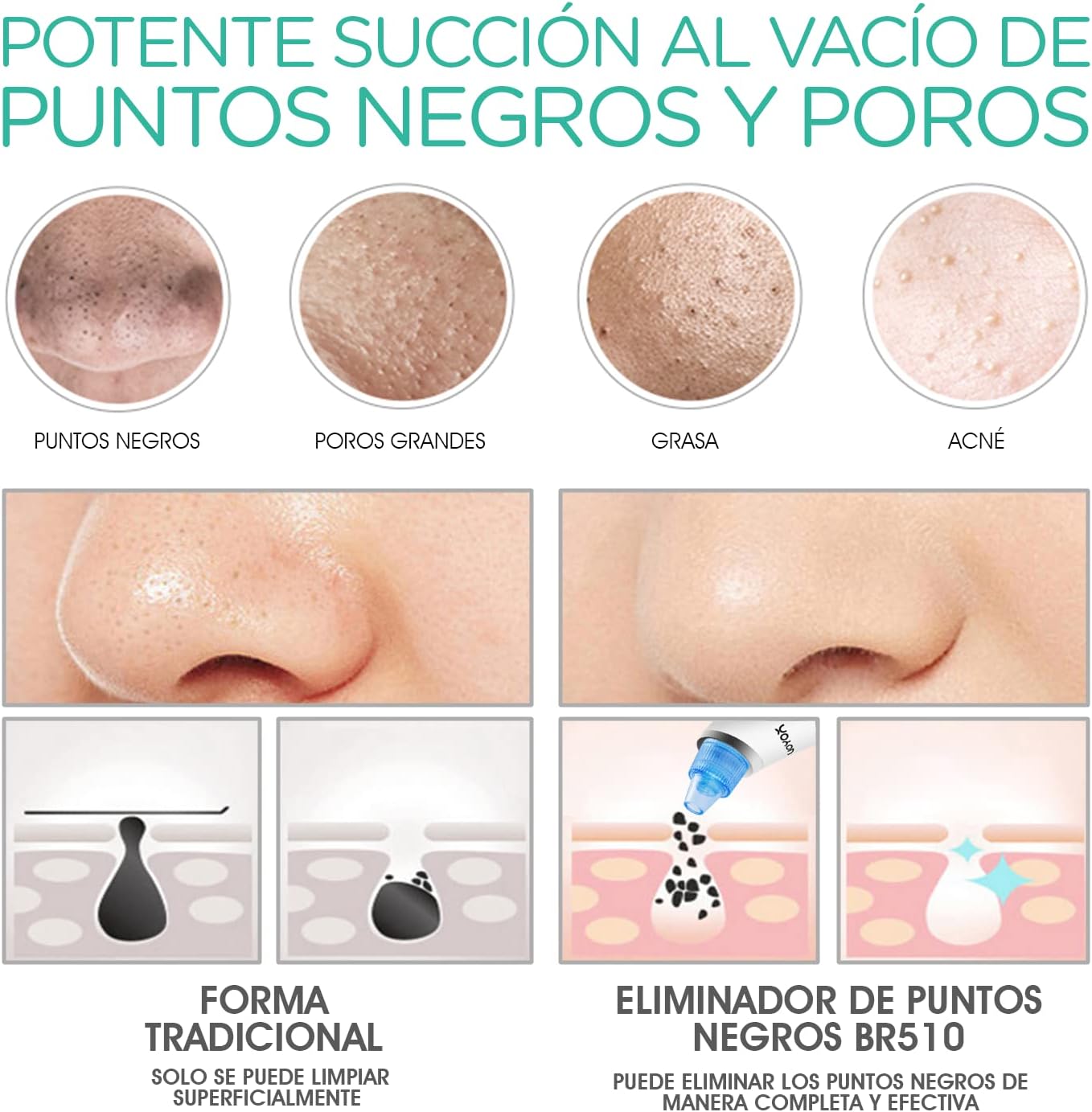 Limpiador Slim™ | Elimina los tóxicos y anti-estéticos puntos negros de tu nariz desde la primera pasada. Efecto rejuvecenedor justificado por más de 23.523 clientas. (Hoy incluye 4 cabezales + Masajeador Facial LED GRATIS)