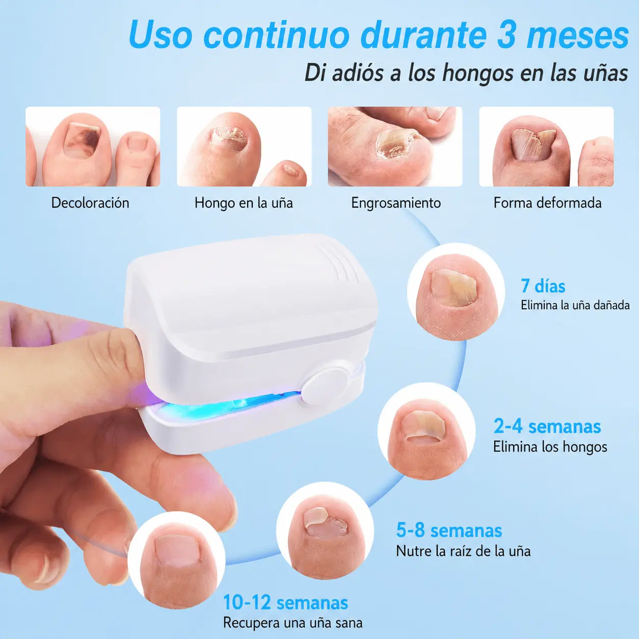 OnyCure v3™ | La luz LED que por fin llega al hongo bajo la uña y lo elimina. (Sesiones de 7 min en casa · 30 días de garantía · Hoy aceite natural GRATIS)