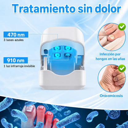 OnyCure v3™ | La luz LED que por fin llega al hongo bajo la uña y lo elimina. (Sesiones de 7 min en casa · 30 días de garantía · Hoy aceite natural GRATIS)