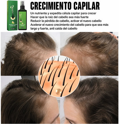Spray Raíz Viva™· El primer spray natural que recupera tu melena sin injertos costosos. Resultados visibles desde los 9 primeros días (HOY REGALO ducha con filtro que evita el daño capilar GRATIS).