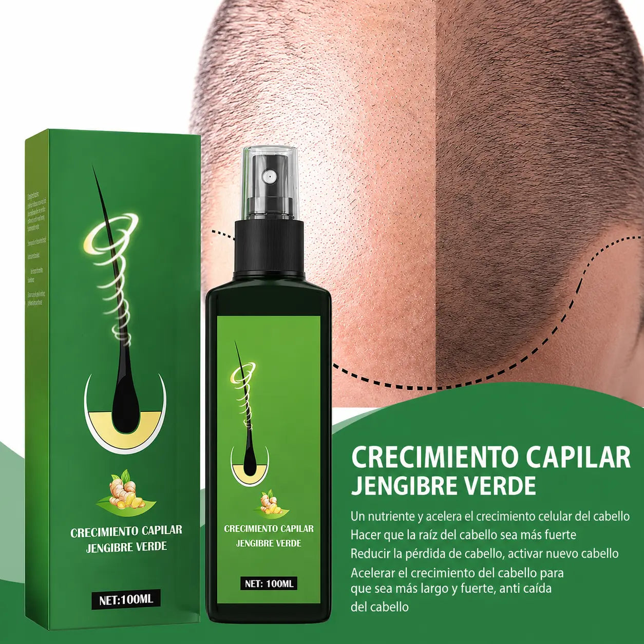 Spray Raíz Viva™· El primer spray natural que recupera tu melena sin injertos costosos. Resultados visibles desde los 9 primeros días (HOY REGALO ducha con filtro que evita el daño capilar GRATIS).