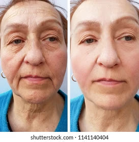 Rutina Binatural™ - Elimina las arrugas del rostro en solo 11 días. Todos te verán reluciente. (Incluye Spray Vitamina C, Bálsamo colágeno y Gratis Masajeador Luz Roja valorado en 80 euros)