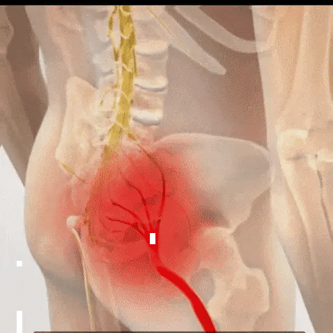 FlexiBack™ – El único cinturón con doble soporte, cómodo y discreto que te permite volver a disfrutar de horas de pie sin dolor lumbar (Hoy GRATIS Almohada Ortopédica valorada en 29 euros).