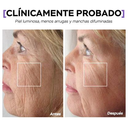 Rutina Binatural™ - Elimina las arrugas del rostro en solo 11 días. Todos te verán reluciente. (Incluye Spray Vitamina C, Bálsamo colágeno y Gratis Masajeador Luz Roja valorado en 80 euros)