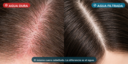 1 + 1 GRATIS | Hydroluxe Cromada Original™ – Cuida tu pelo y el de tu familia: filtra el agua (cal y cloro) que agrede tu raíz. (Incluye 12 filtros GRATIS para todo el año + 30 días de prueba)