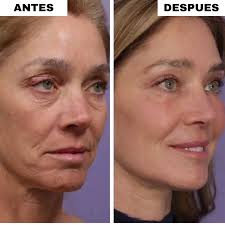 Rutina Binatural™ - Elimina las arrugas del rostro en solo 11 días. Todos te verán reluciente. (Incluye Spray Vitamina C, Bálsamo colágeno y Gratis Masajeador Luz Roja valorado en 80 euros)